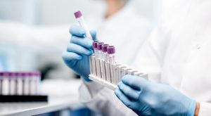 Scientist holding test tubes in a lab
